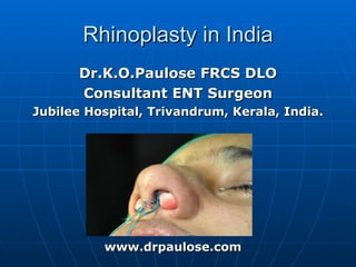 Rhinoplasty in India
       Dr.K.O.Paulose FRCS DLO
       Consultant ENT Surgeon
Jubilee Hospital, Trivandrum, Kerala, India.




          www.drpaulose.com
 