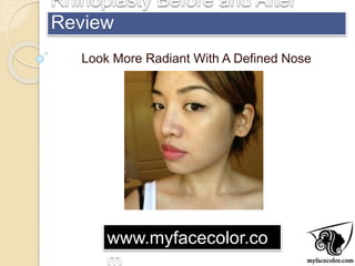 Rhinoplasty Before and After
Review
Look More Radiant With A Defined Nose
www.myfacecolor.co
m
 