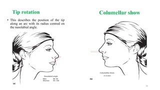 Rhinoplasty dr. rk | PPTX