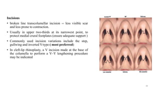 Osr Inverted V Incision Rhinoplasty dr. rk | PPTX