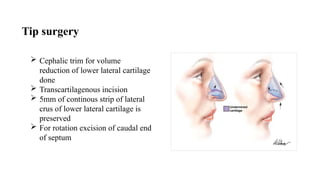 RHINOPLASTY indications and complications | PPTX