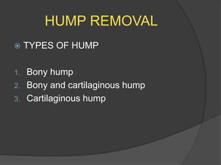 HUMP REMOVAL
 TYPES OF HUMP
1. Bony hump
2. Bony and cartilaginous hump
3. Cartilaginous hump
 