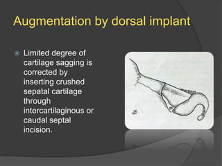 Augmentation by dorsal implant
 Limited degree of
cartilage sagging is
corrected by
inserting crushed
sepatal cartilage
through
intercartilaginous or
caudal septal
incision.
 