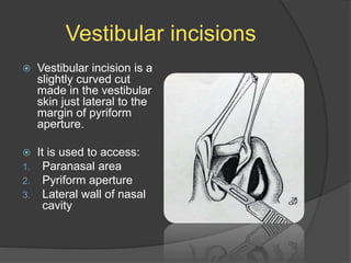 Vestibular incisions
 Vestibular incision is a
slightly curved cut
made in the vestibular
skin just lateral to the
margin of pyriform
aperture.
 It is used to access:
1. Paranasal area
2. Pyriform aperture
3. Lateral wall of nasal
cavity
 