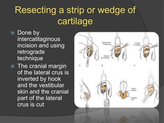Resecting a strip or wedge of
cartilage
 Done by
intercatilaginous
incision and using
retrograde
technique
 The cranial margin
of the lateral crus is
inverted by hook
and the vestibular
skin and the cranial
part of the lateral
crus is cut
 