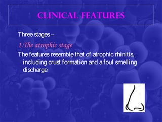Rhinoscleroma | PPT