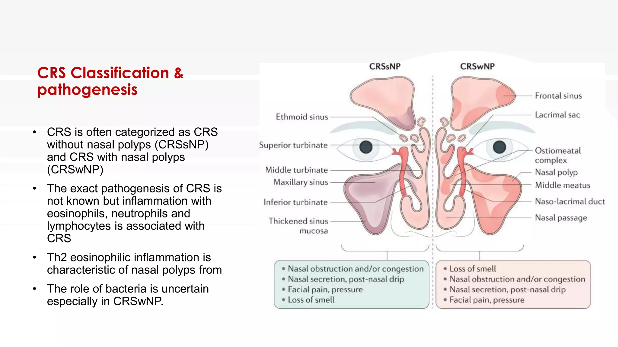 Rhinosinusitis | PDF