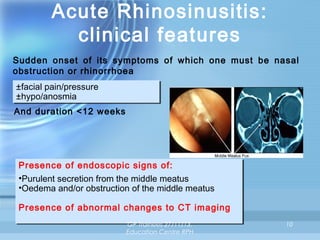 Acute Rhinosinusitis:
clinical features
Sudden onset of its symptoms of which one must be nasal
obstruction or rhinorrhoea
±facial pain/pressure
±facial pain/pressure
±hypo/anosmia
±hypo/anosmia
And duration <12 weeks

Presence of endoscopic signs of:
Presence of endoscopic signs of:
••Purulent secretion from the middle meatus
Purulent secretion from the middle meatus
••Oedema and/or obstruction of the middle meatus
Oedema and/or obstruction of the middle meatus
Presence of abnormal changes to CT imaging
Presence of abnormal changes to CT imaging
GP Trainees 27/11/13,
Education Centre RPH

10

 