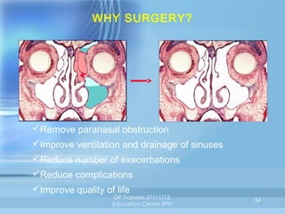WHY SURGERY?

Remove paranasal obstruction
Improve ventilation and drainage of sinuses
Reduce number of exacerbations
Reduce complications
Improve quality of life

GP Trainees 27/11/13,
Education Centre RPH

54

 