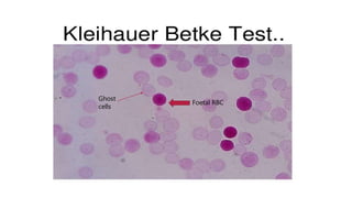 Foetal RBC
Ghost
cells
 