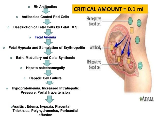 Rh Isoimmunization