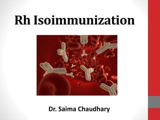 Rh Isoimmunization
Dr. Saima Chaudhary
 