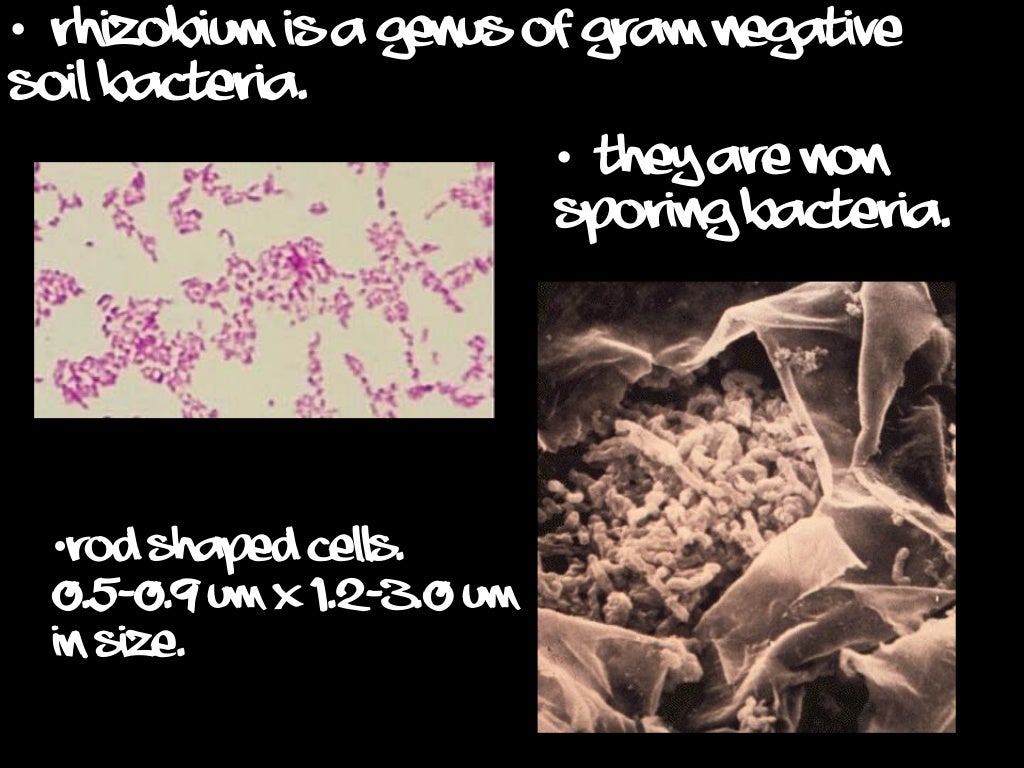 Rhizobium Microbiology Science Learning Educative Presentation