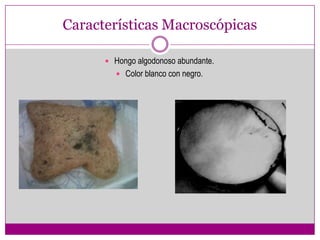 Características Macroscópicas

       Hongo algodonoso abundante.
         Color blanco con negro.
 