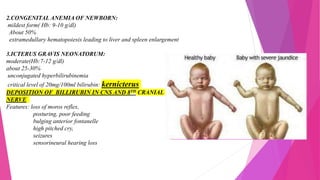 One Seminar on rh negative pregnancy.pptx