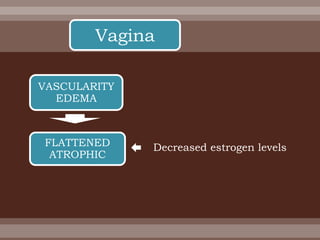 Vagina
VASCULARITY
EDEMA
FLATTENED
ATROPHIC
Decreased estrogen levels
 