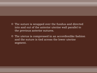  The suture is wrapped over the fundus and directed
into and out of the anterior uterine wall parallel to
the previous anterior sutures.
 The uterus is compressed in an accordionlike fashion
and the suture is tied across the lower uterine
segment.
 