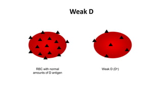 RBC with normal
amounts of D antigen
Weak D (Du)
Weak D
 