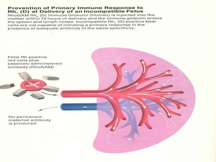 Rh Rhesus Isoimmunization