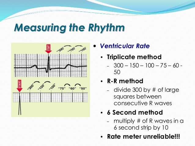 Rhythm Recognition