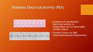 Rhythm recognition | PPTX