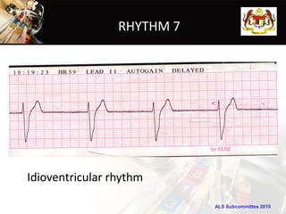 RHYTHM 7




Idioventricular rhythm

                            ALS Subcommittee 2010
 