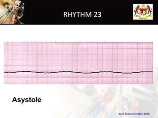 RHYTHM 23




Asystole
                       ALS Subcommittee 2010
 