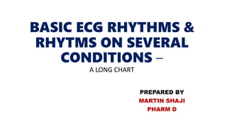 BASIC ECG RHYTHMS &
RHYTMS ON SEVERAL
CONDITIONS –
A LONG CHART
PREPARED BY
MARTIN SHAJI
PHARM D
 