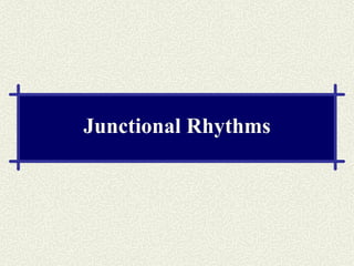 Junctional Rhythms 