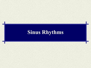 Sinus Rhythms 