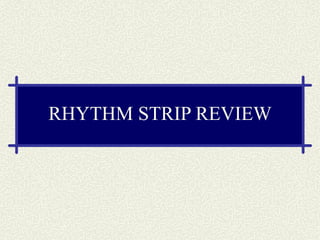 RHYTHM STRIP REVIEW 