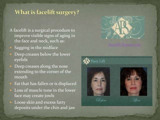 What is facelift surgery?A facelift is a surgical procedure to improve visible signs of aging in the face and neck, such as:Sagging in the midfaceDeep creases below the lower eyelidsDeep creases along the nose extending to the corner of the mouthFat that has fallen or is displacedLoss of muscle tone in the lower face may create jowlsLoose skin and excess fatty deposits under the chin and jawFacelift Kansas city