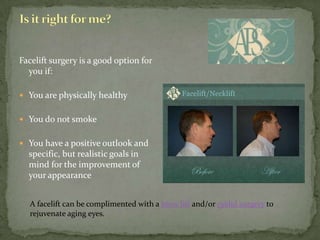 Is it right for me?Facelift surgery is a good option for you if:You are physically healthyYou do not smokeYou have a positive outlook and specific, but realistic goals in mind for the improvement of your appearanceA facelift can be complimented with a brow lift and/or eyelid surgery to rejuvenate aging eyes.  