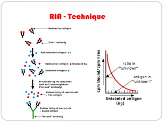 RIA - Technique
 
