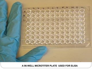 A 96-WELL MICROTITER PLATE USED FOR ELISA
 