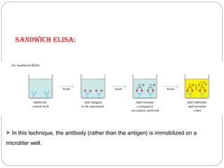  In this technique, the antibody (rather than the antigen) is immobilized on a
microtiter well.
sAndwIch eLIsA:
 