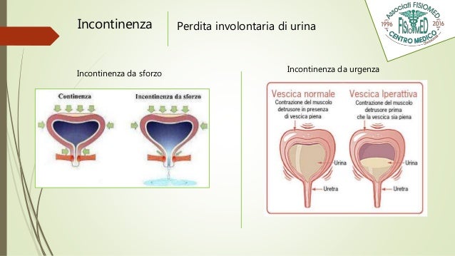 Elettrostimolatore Muscolare Pelvico con Sonda Vaginale e Anale per Esercizi di Kegel e Terapia dell'Incontinenza