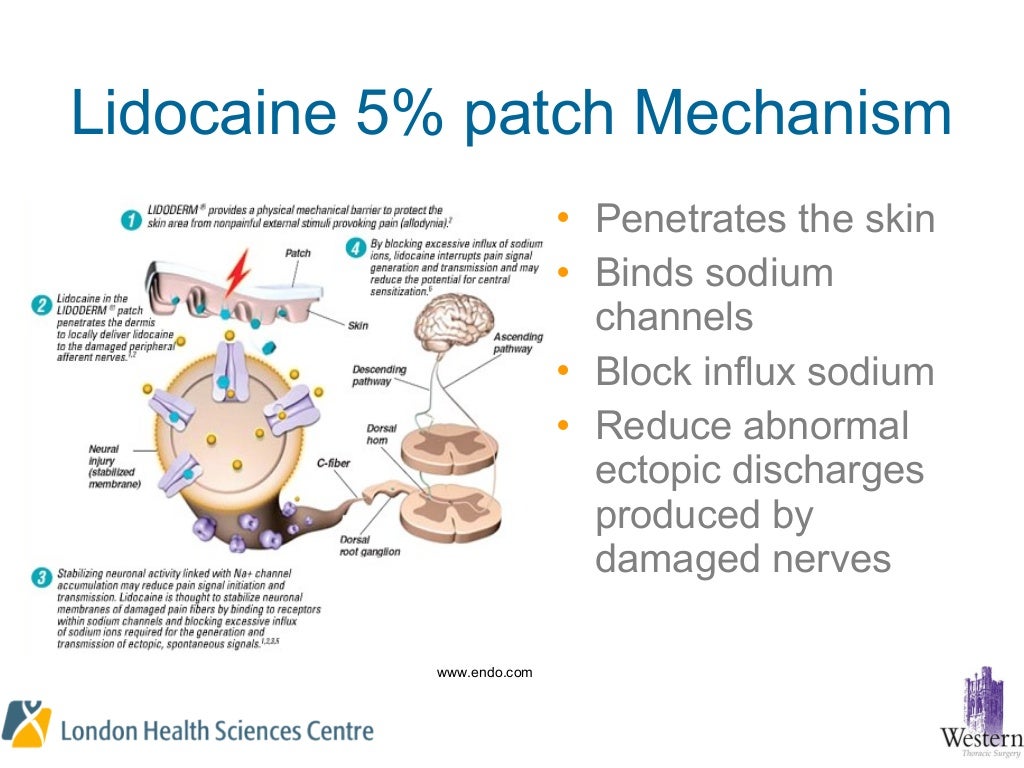 Rib fracture by dr.saleh bakar