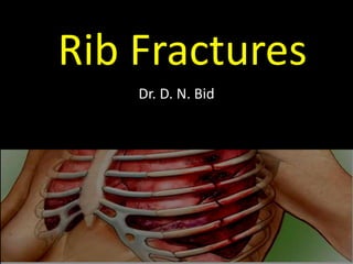 Rib Fractures
Dr. D. N. Bid
 