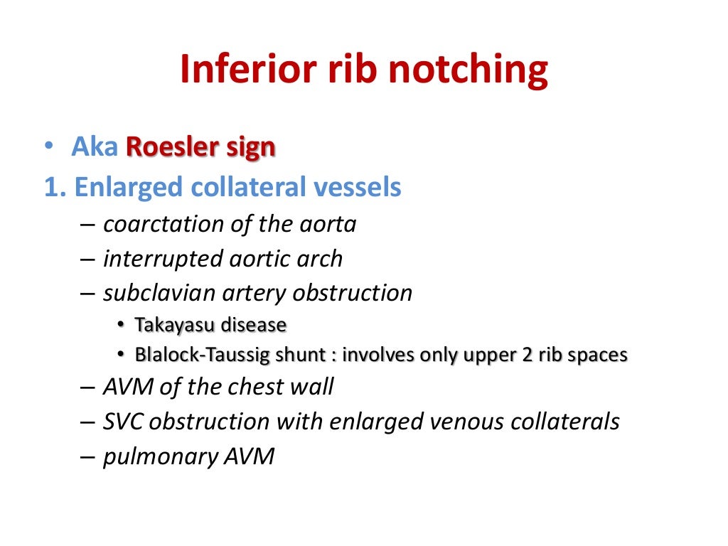 Rib notching