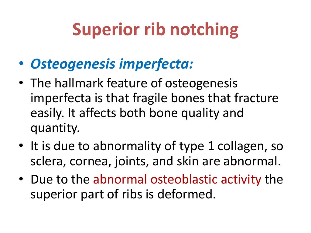 Rib notching