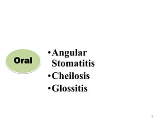 18
Oral
•Angular
Stomatitis
•Cheilosis
•Glossitis
 