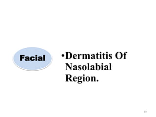19
Facial •Dermatitis Of
Nasolabial
Region.
 
