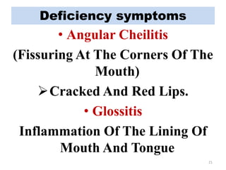 Deficiency symptoms
• Angular Cheilitis
(Fissuring At The Corners Of The
Mouth)
Cracked And Red Lips.
• Glossitis
Inflammation Of The Lining Of
Mouth And Tongue
21
 