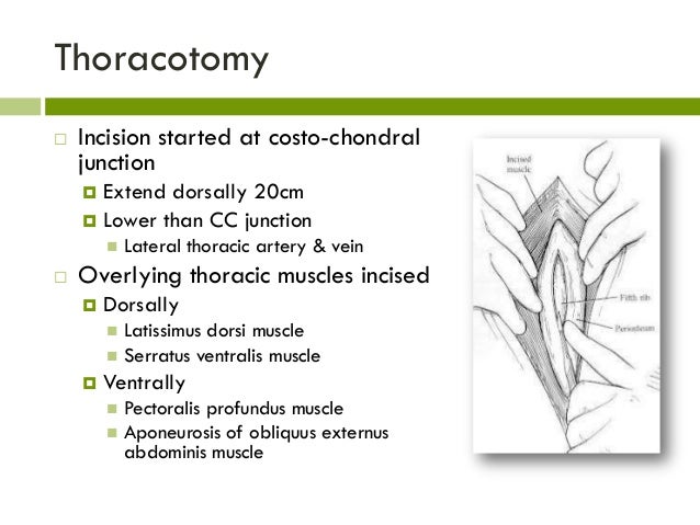 pericardial sac