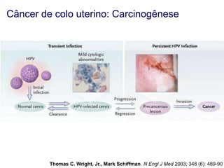 Câncer de colo uterino: Carcinogênese

Thomas C. Wright, Jr., Mark Schiffman. N Engl J Med 2003; 348 (6): 489-90

 