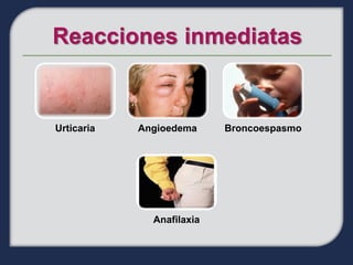 Urticaria   Angioedema     Broncoespasmo




              Anafilaxia
 