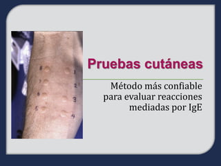 Método más confiable
para evaluar reacciones
      mediadas por IgE
 