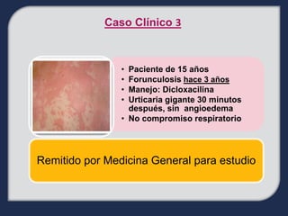 Caso Clínico 3



                • Paciente de 15 años
                • Forunculosis hace 3 años
                • Manejo: Dicloxacilina
                • Urticaria gigante 30 minutos
                  después, sin angioedema
                • No compromiso respiratorio




Remitido por Medicina General para estudio
 