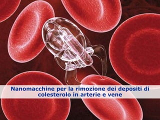 Nanomacchine per la rimozione dei depositi di
colesterolo in arterie e vene
 